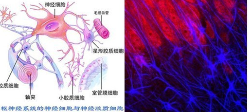 老年癫痫的常见病因有哪些